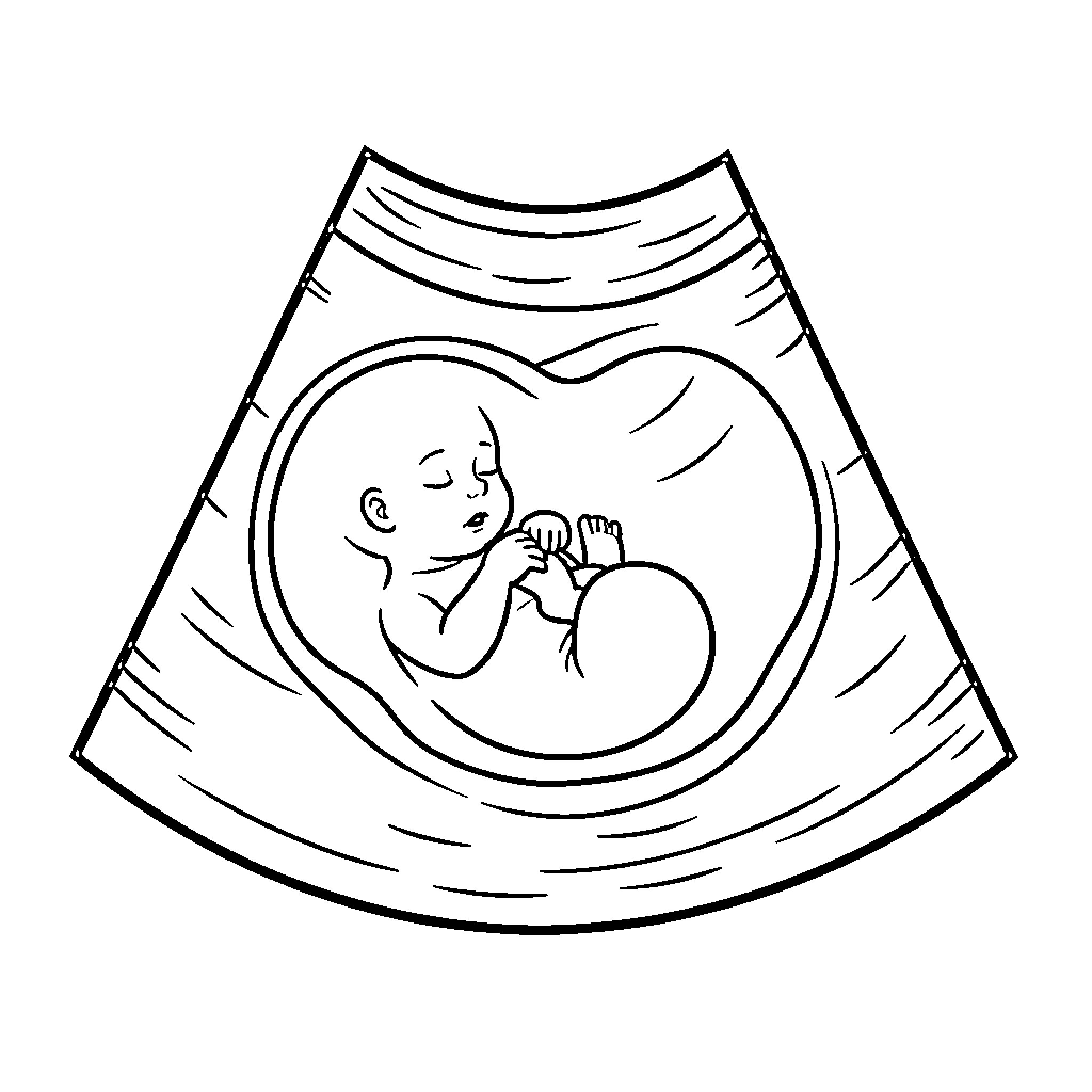 Baby resting peacefully in ultrasound image Coloring Page (free black-and-white line drawing printable PDF for all, from beginners to advanced learners, including children, teens, adults, and seniors)